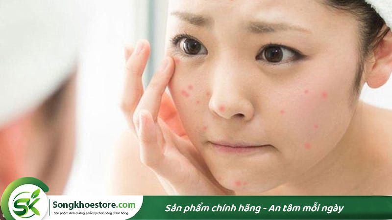 uong-bot-protein-thuc-vat-co-noi-mun